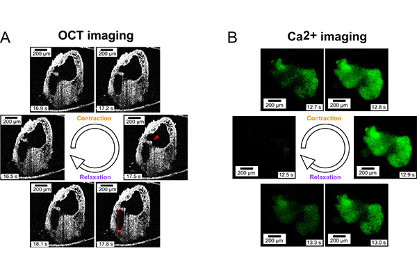  Zhou’s team used optical coherence tomography (left) and calcium imaging (right) to take a closer look at the structure and activity in the human heart organoid, which provides a look at the chambers, blood vessels, heart valves and other structures in the heart. (Zhou lab)