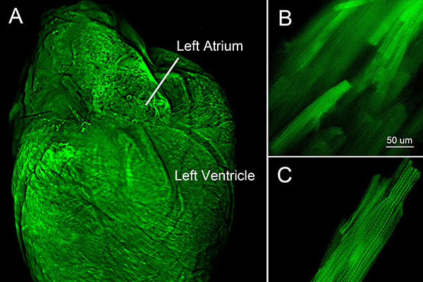 In vivo viral-mediated gene transfer, visualized using enhanced green fluorescent protein (eGFP), enables acute manipulation of ion channel subunit expression in the atria and ventricles of the adult mouse heart (A).