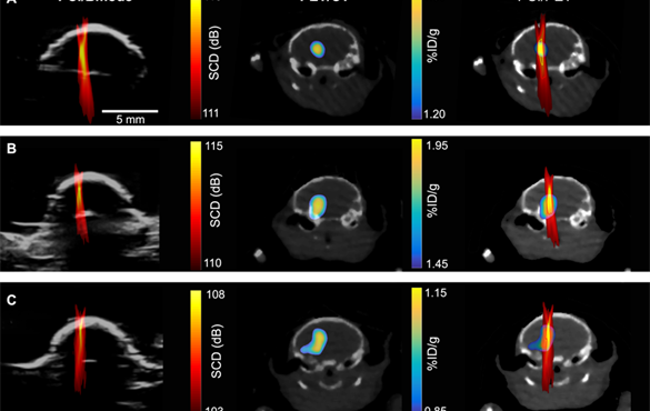 Researchers are one step closer to delivering precise amounts of medication to exact location, repurposing an existing imaging "painting" method. Cavitation images (left); PET images (middle); overlay of the two (right). (Courtesy: Hong Chen lab)