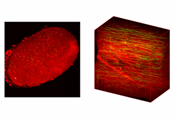 The image on the left shows a cross-sectional image of collagen in a mouse tibialis anterior tendon. On the right is an optically cleared mouse Achilles tendon showing elastic fibers (green) and collagen fibers (red) along the depth of the tendon.  