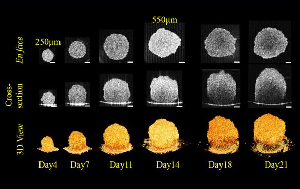 This image shows the growth dynamics of 3D tumor spheroids measured with optical coherence tomography (OCT), a type of optical imaging technology that Chao Zhou is using in his lab.