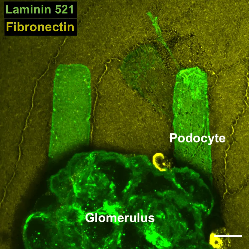 Researchers from McKelvey School of Engineering and the School of Medicine have created a technology that shows them how changes to the kidney associated with diabetes and elevated blood sugar affect the mechanical function of podocytes and their ability to recover, which has potential toward finding new treatments for chronic kidney disease. (Suleiman lab)