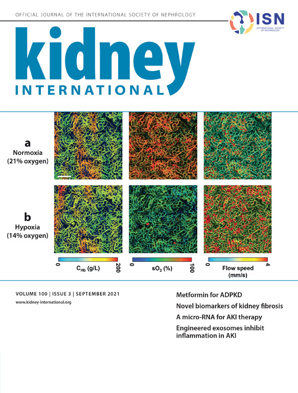 The paper is the cover story of the September 2021 print issue of Kidney International.
