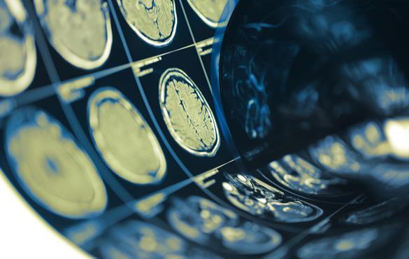 Researchers, led by Philip V. Bayly, will use MRI to study the brains of healthy, uninjured individuals to create models of brain motion to predict the chronic effects of repeated head impacts in both men and women. (Image: Shutterstock)
